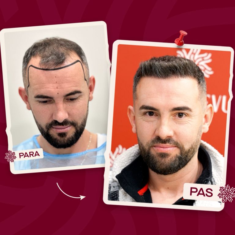 Trandevue_Video_2025_04_11_1_Landscape.00_00_06_04.Still001