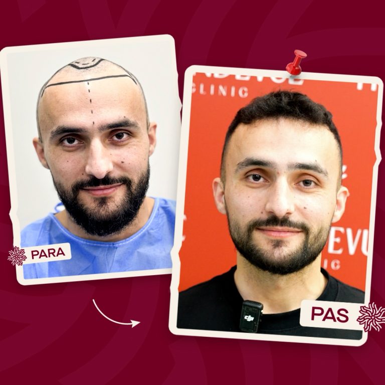 Trandevue_Video_2025_04_11_1_Landscape.00_00_09_05.Still002