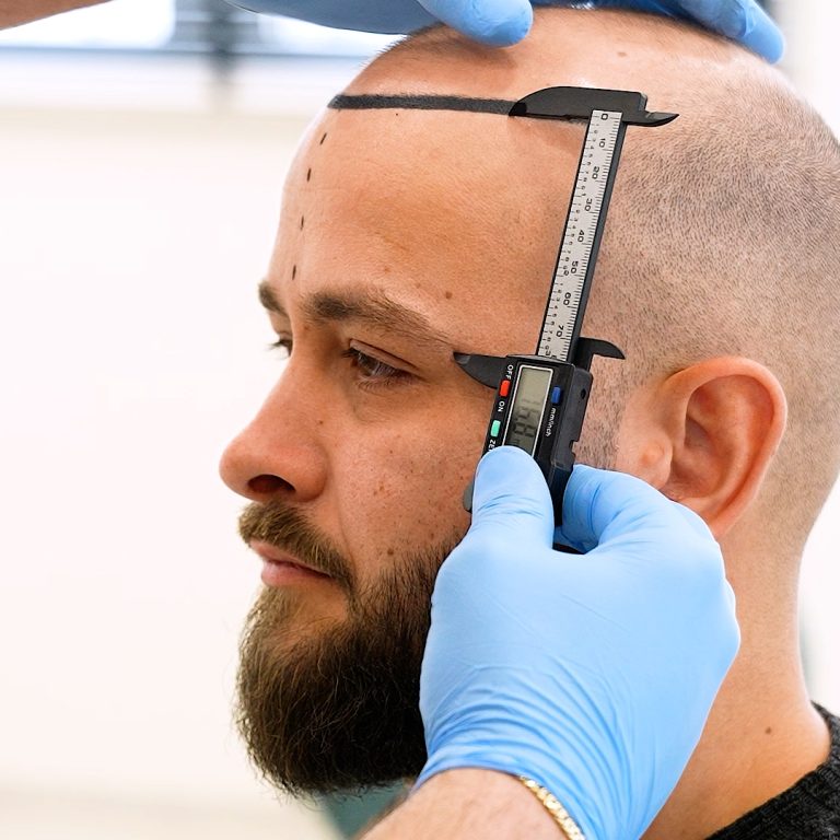 Trandevue_Video_2025_04_11_1_Landscape.00_00_23_21.Still004