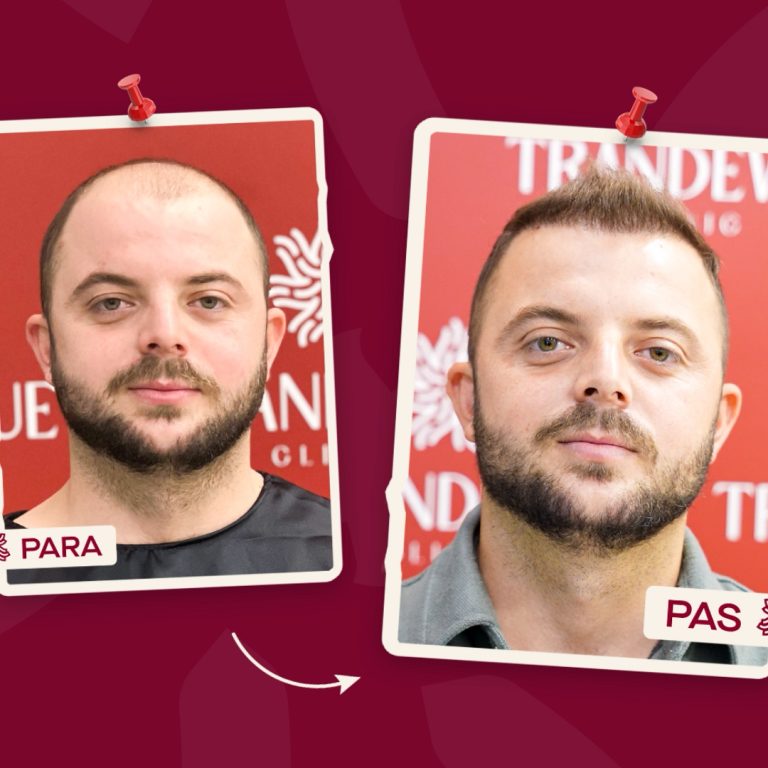 Trandevue_Video_2025_04_11_1_Landscape.00_00_34_19.Still006